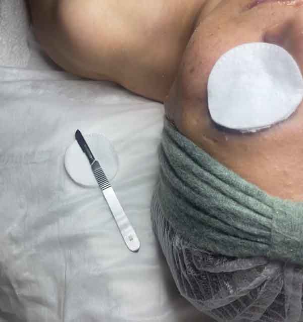 فیشیال پاکسازی صورت