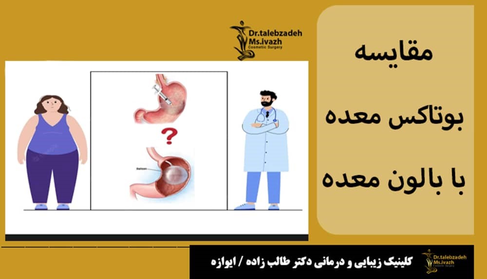 مقایسه بالون معده با بوتاکس معده